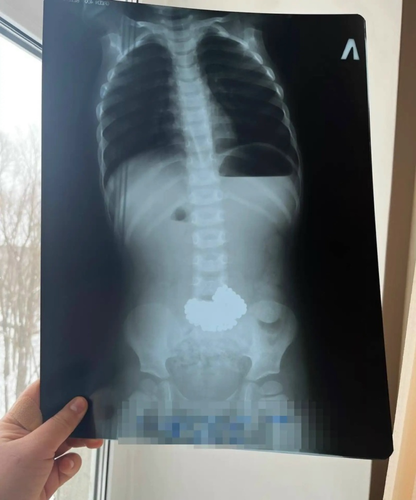 Клинический случай